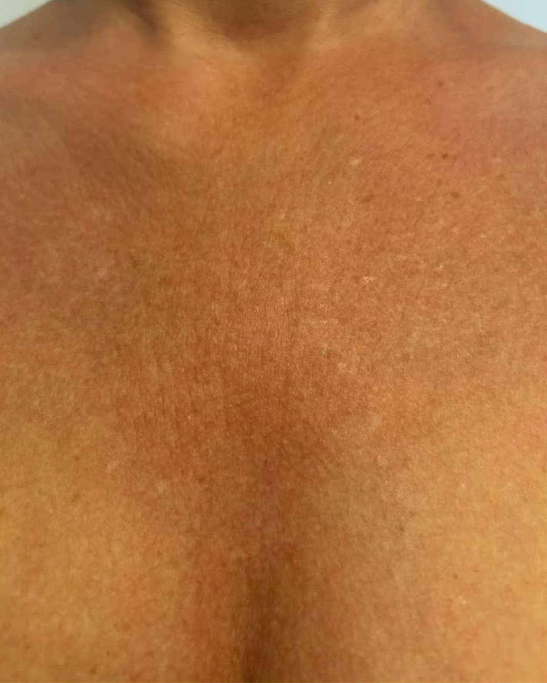 Skin Gloss efter