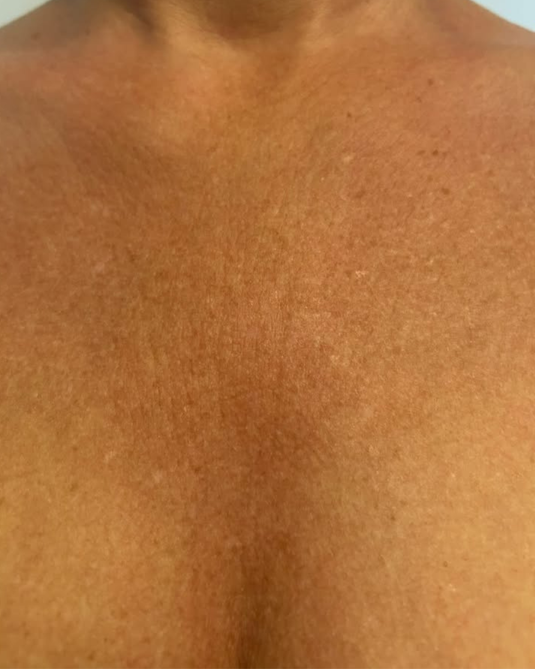 Skin Gloss efter